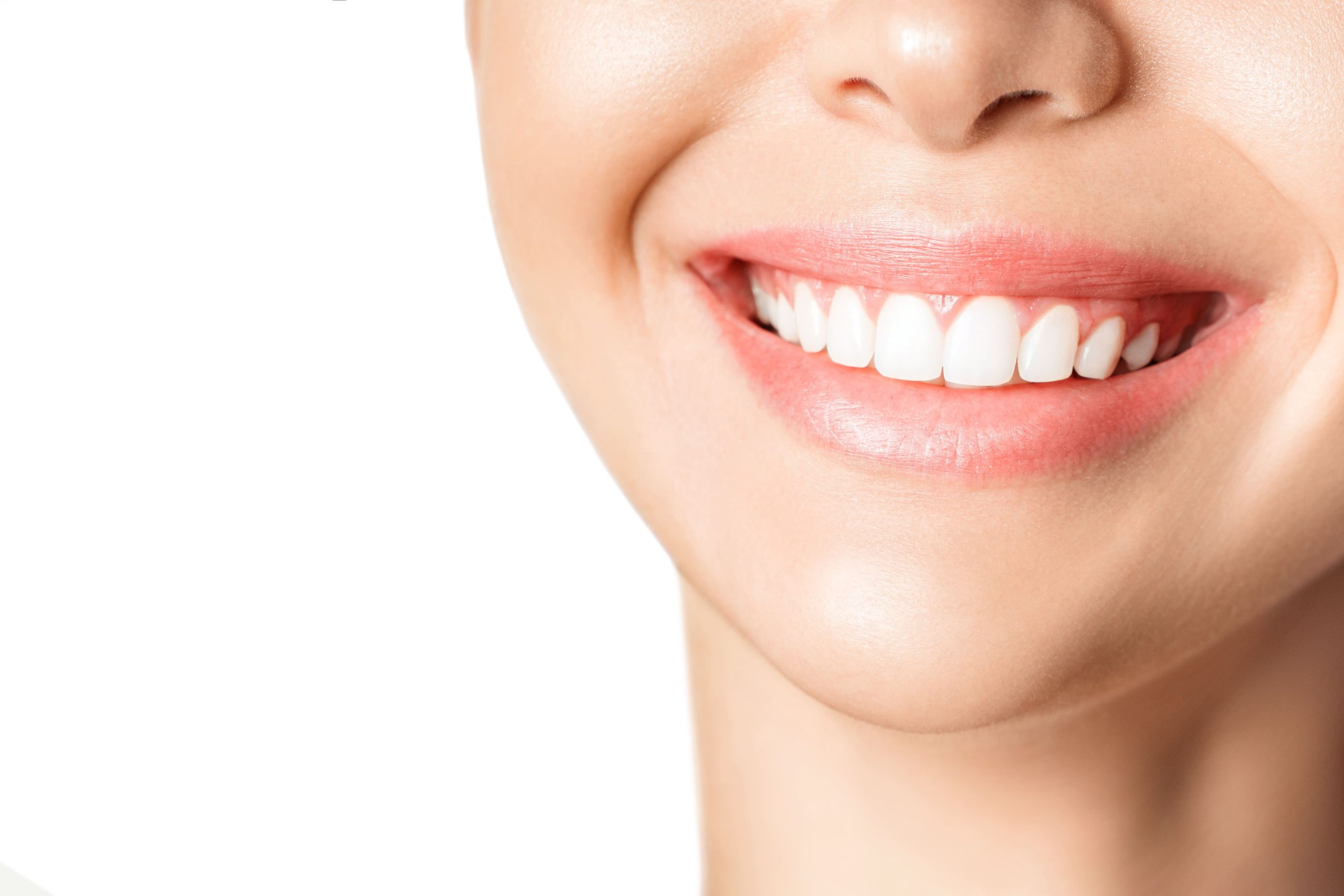 Blanqueamiento dental: una gran opción para tu sonrisa