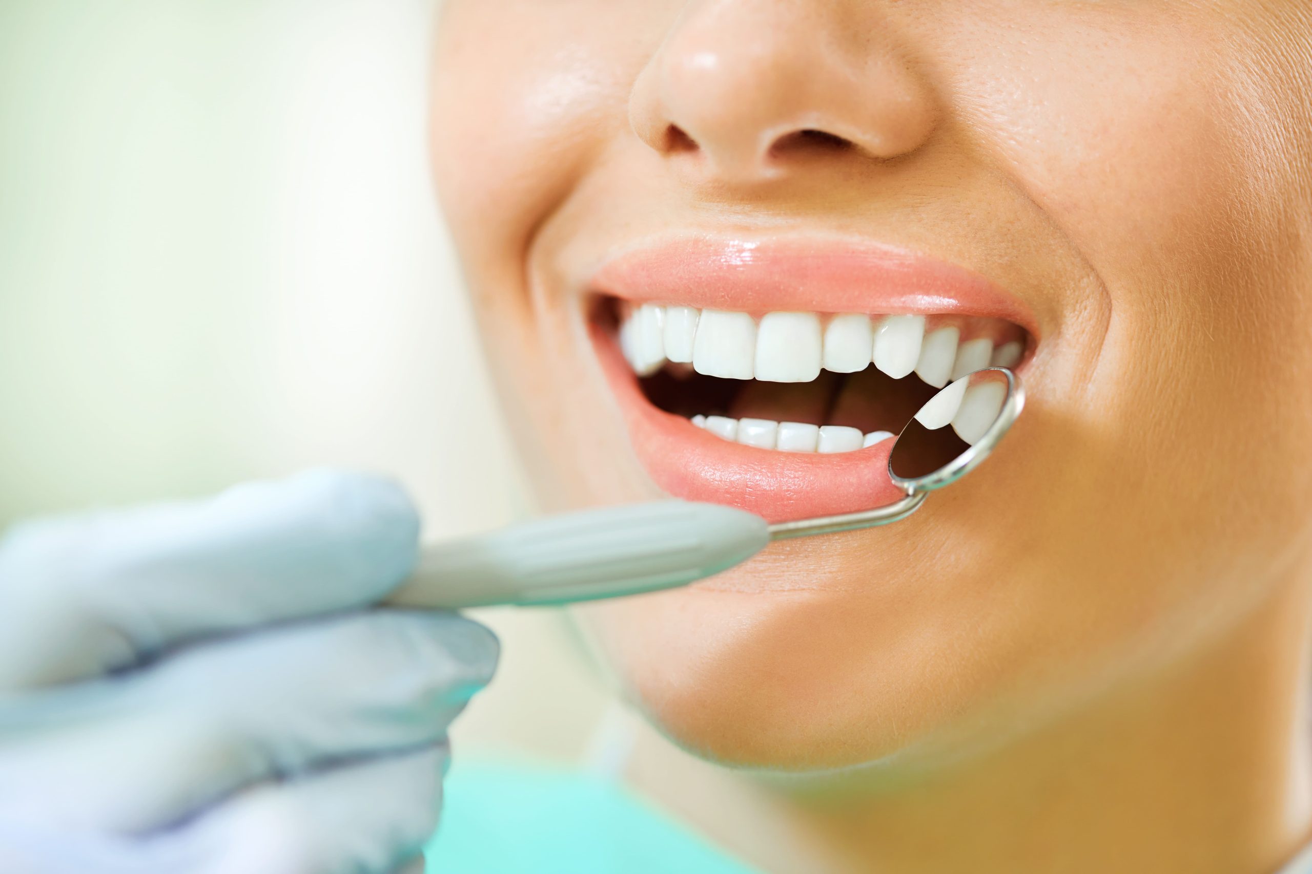 Blanqueamiento dental: ¿Por qué es una buena opción?