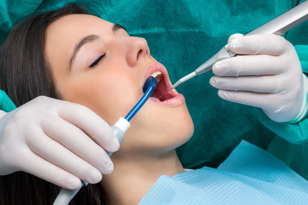 La limpieza dental es un proceso profiláctico que permite eliminar el sarro y la placa bacteriana causantes de enfermedades bucales.