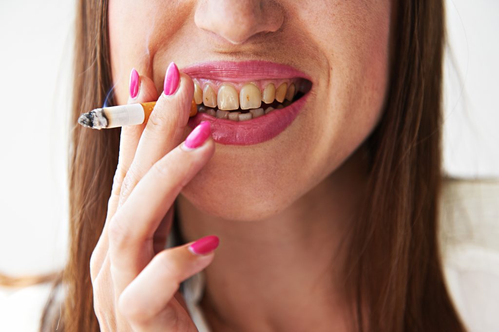 Muestra a una mujer sonriendo mientras sostiene un cigarrillo, con dientes visiblemente manchados por el tabaco.