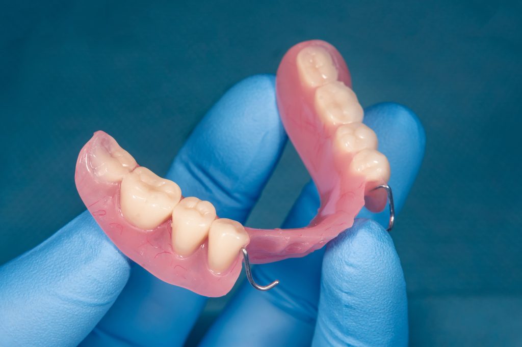 La prótesis dental restaura la funcionalidad de la boca tras la pérdida de piezas. Conoce sus beneficios para adultos mayores.