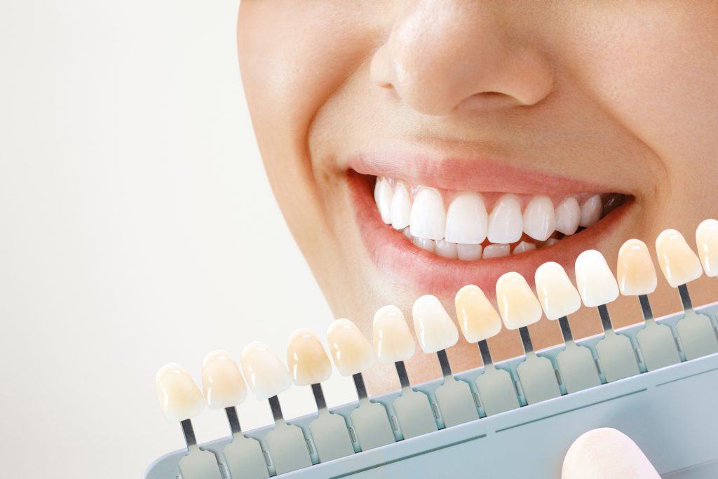 ¿No sabes cómo mejorar la apariencia de tu sonrisa? Te contamos las diferencias entre limpieza y blanqueamiento dental.