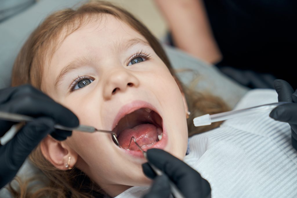 Los sellantes dentales son clave en odontología para prevenir caries y proteger áreas de difícil acceso, conservando las piezas dentales.