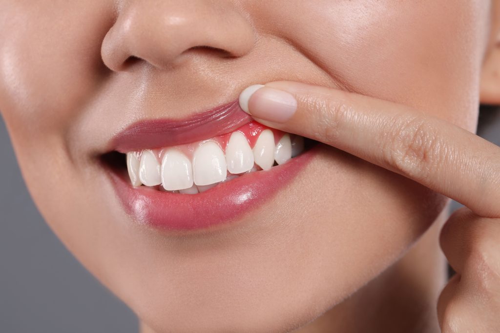 ¿Listo para transformar tu dentadura? Conoce los aspectos clave a considerar antes del blanqueamiento dental. Obtén una sonrisa más luminosa.