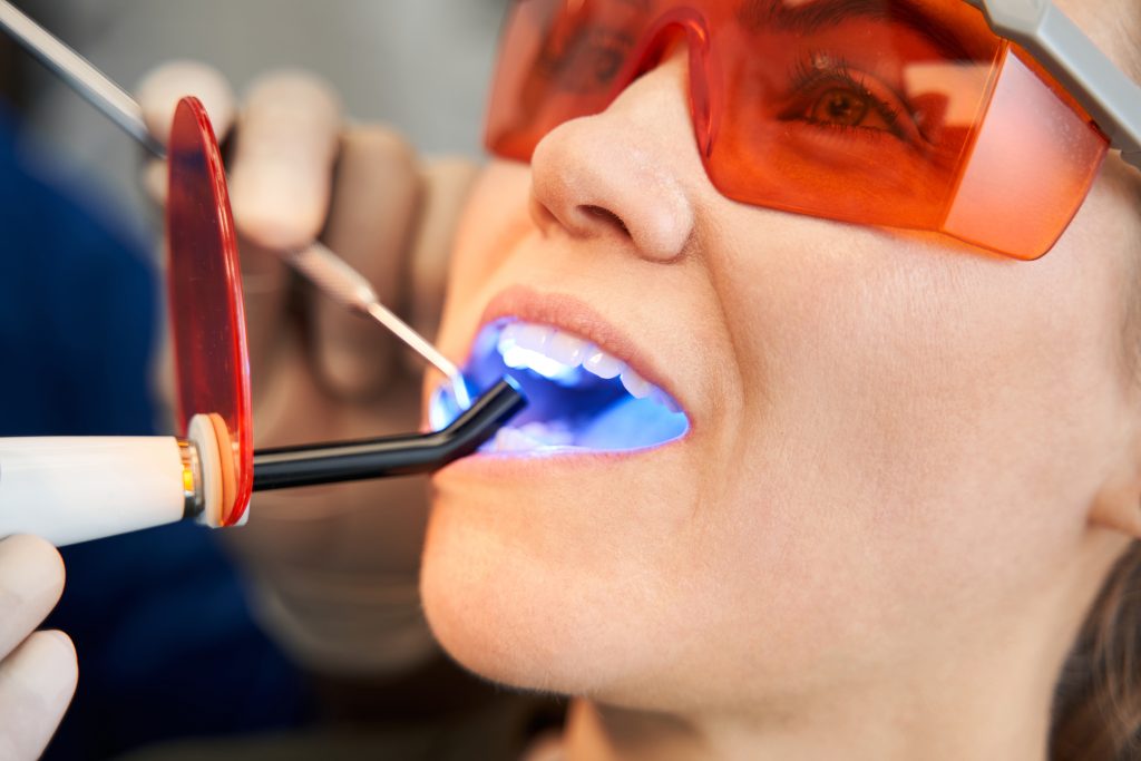 Conoce los secretos del blanqueamiento dental y elige el método perfecto para ti. ¡Comienza hoy a transformar tu sonrisa!